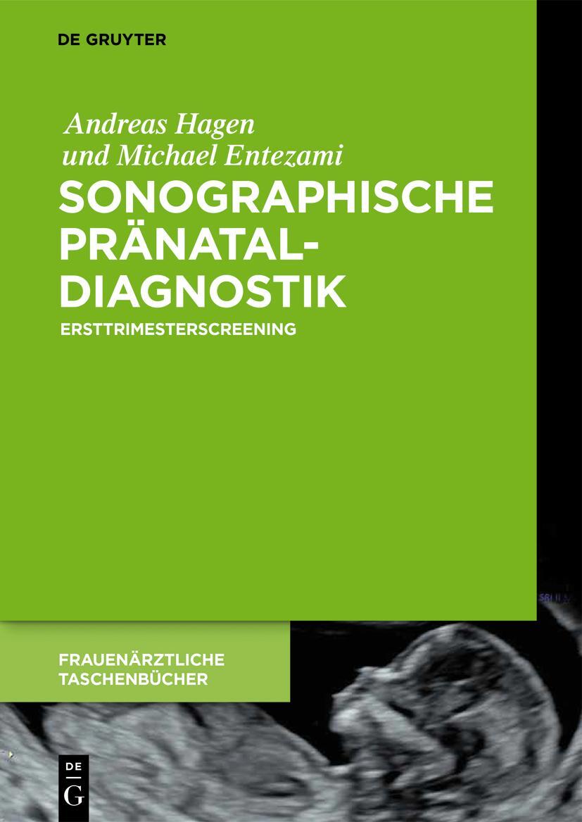 Cover: 9783110535501 | Sonographische Pränataldiagnostik | Ersttrimesterscreening | Buch