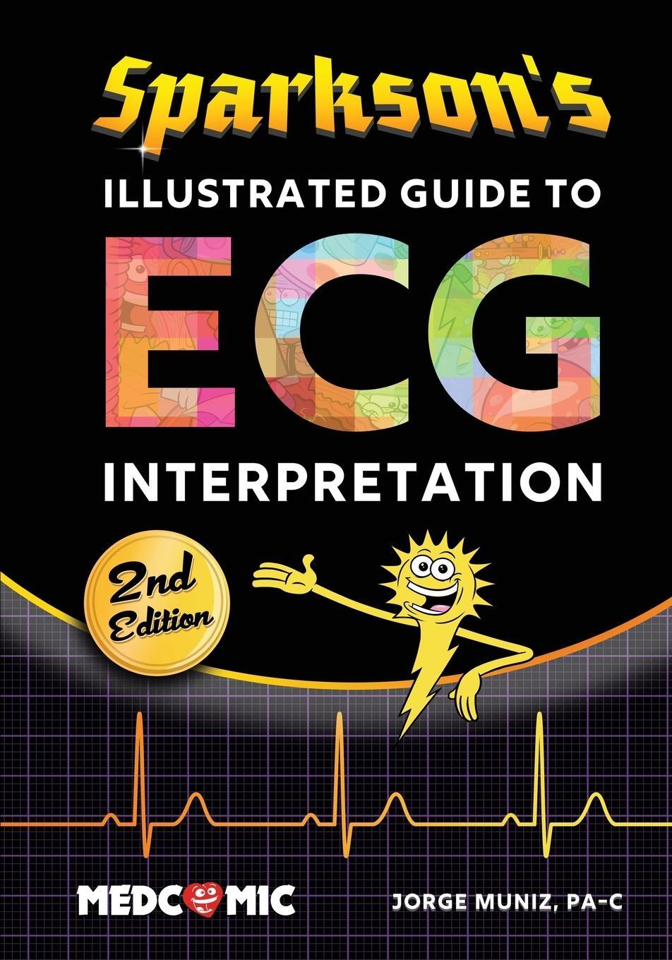Cover: 9780996651370 | Sparkson's Illustrated Guide to ECG Interpretation, 2nd Edition | Buch