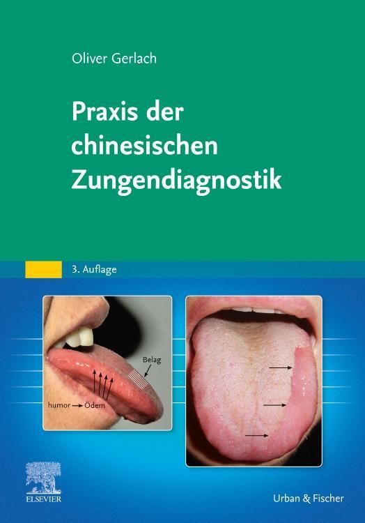 Cover: 9783437550270 | Praxis der chinesischen Zungendiagnostik | Oliver Gerlach | Buch