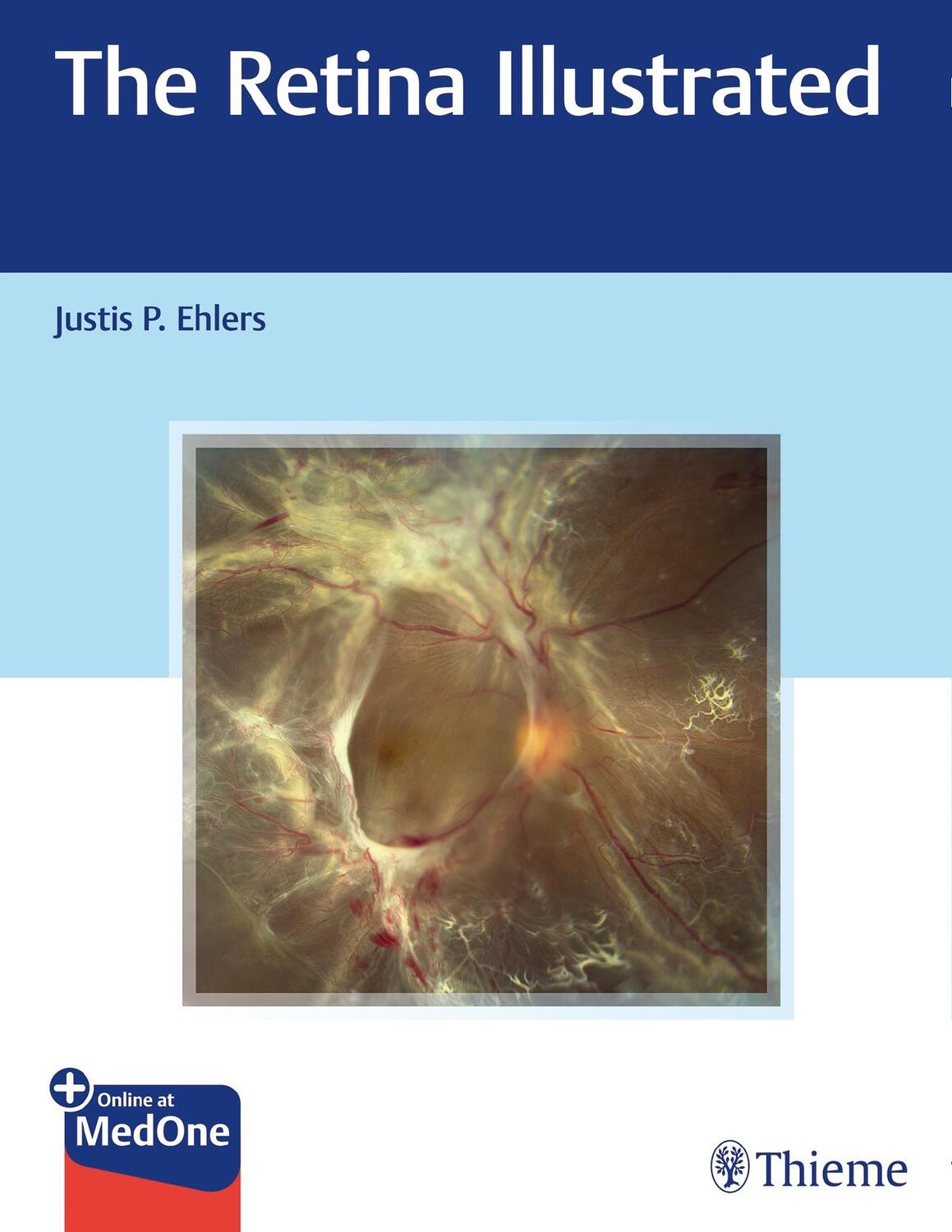 Cover: 9781626238312 | The Retina Illustrated | Justis Ehlers | Taschenbuch | 1 Taschenbuch