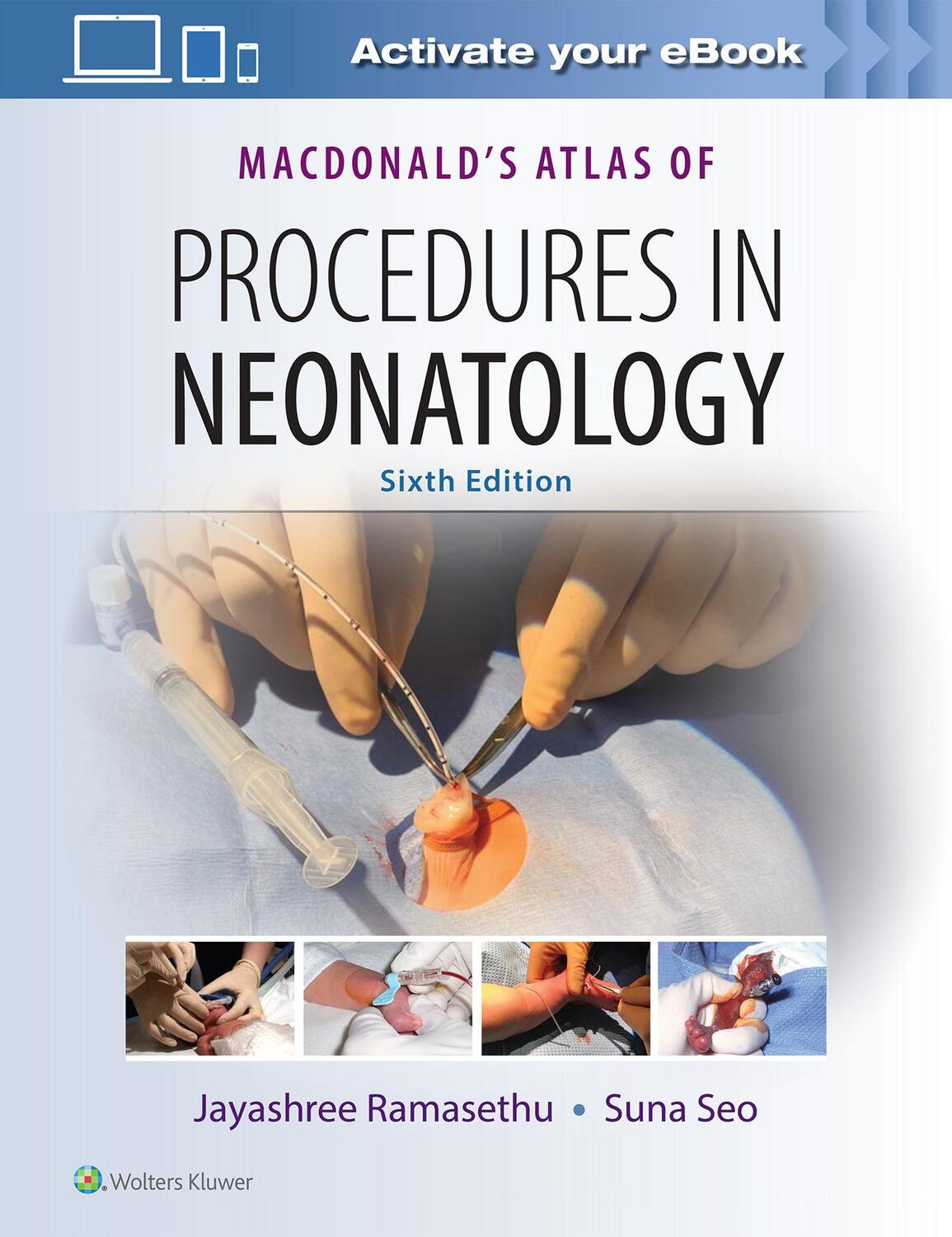 Cover: 9781496394255 | MacDonald's Atlas of Procedures in Neonatology | Jayashree Ramasethu