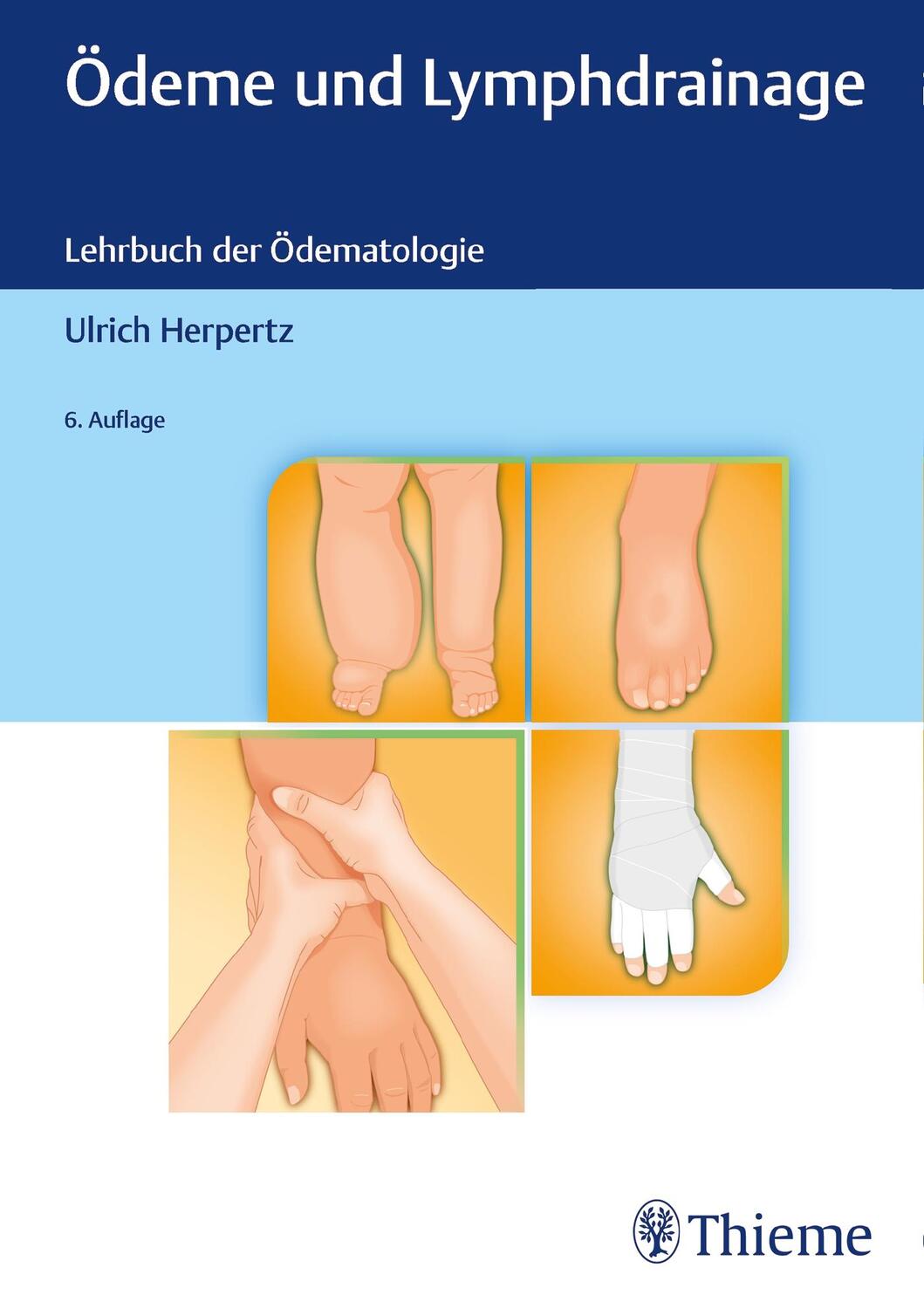 Cover: 9783132435803 | Ödeme und Lymphdrainage | Diagnose und Therapie | Ulrich Herpertz