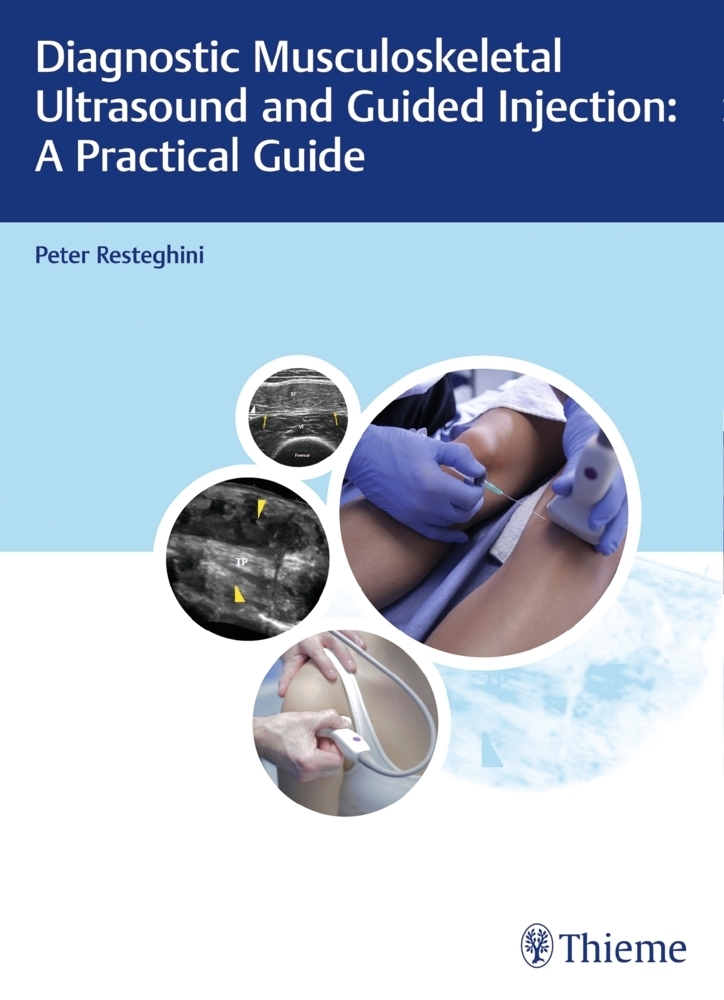 Cover: 9783132203815 | Diagnostic Musculoskeletal Ultrasound and Guided Injection: A...