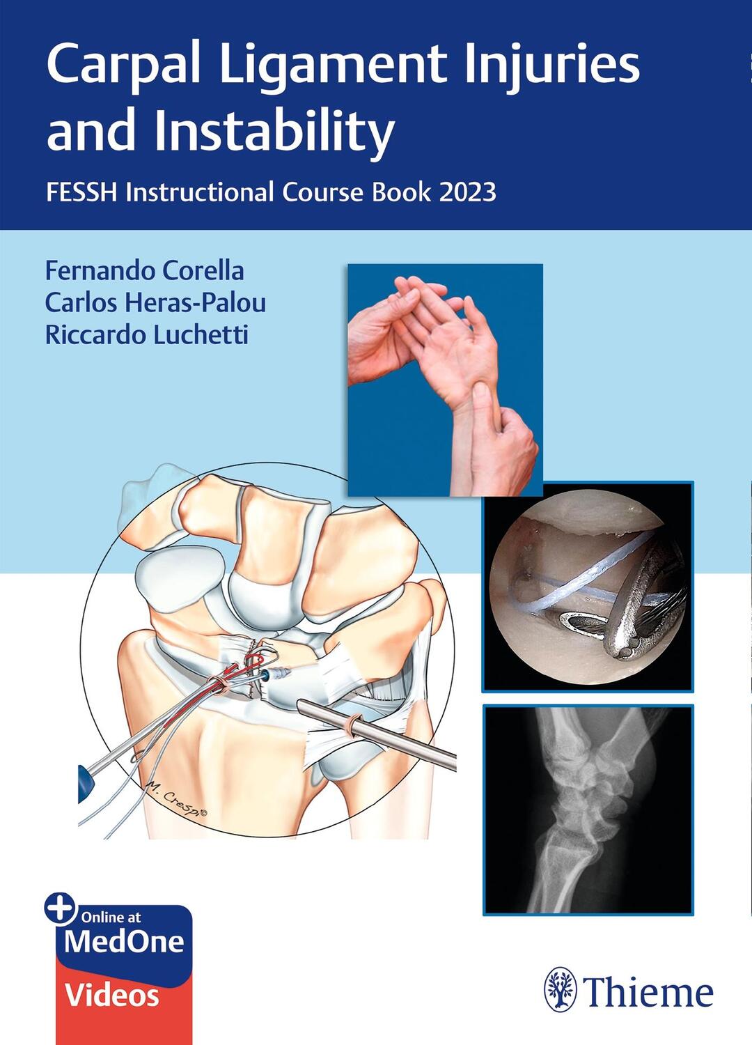 Cover: 9783132451896 | Carpal Ligament Injuries and Instability | Carlos Heras-Palou (u. a.)