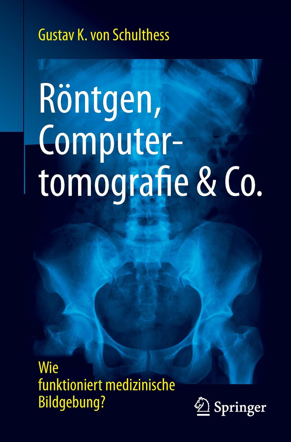 Cover: 9783662539309 | Röntgen, Computertomografie & Co. | Gustav K von Schulthess | Buch