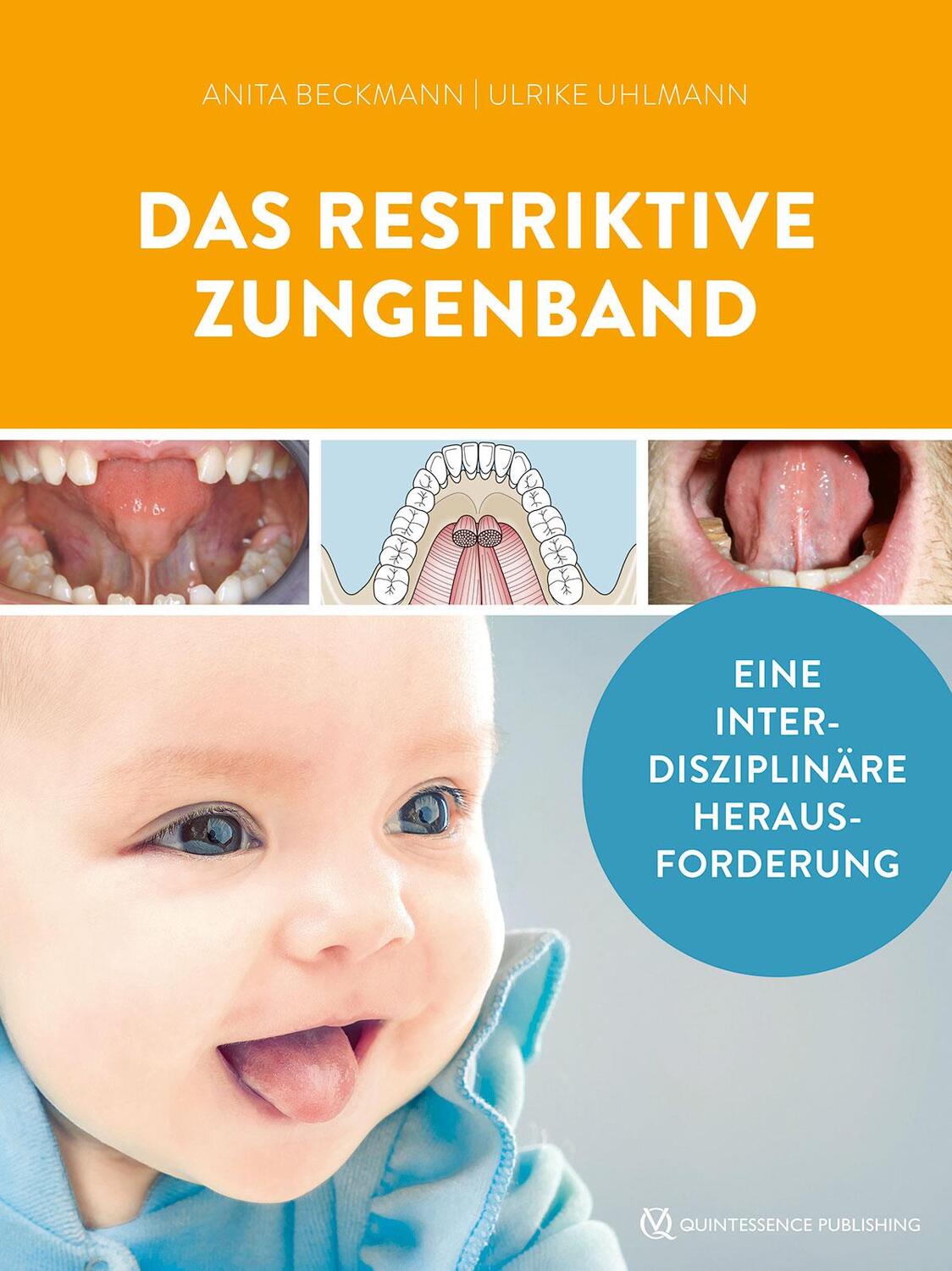 Cover: 9783868676105 | Das restriktive Zungenband | Eine interdisziplinäre Herausforderung