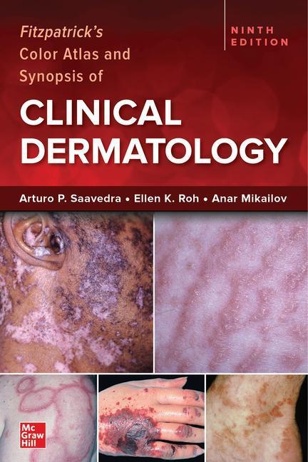 Cover: 9781264278015 | Fitzpatrick's Color Atlas and Synopsis of Clinical Dermatology,...