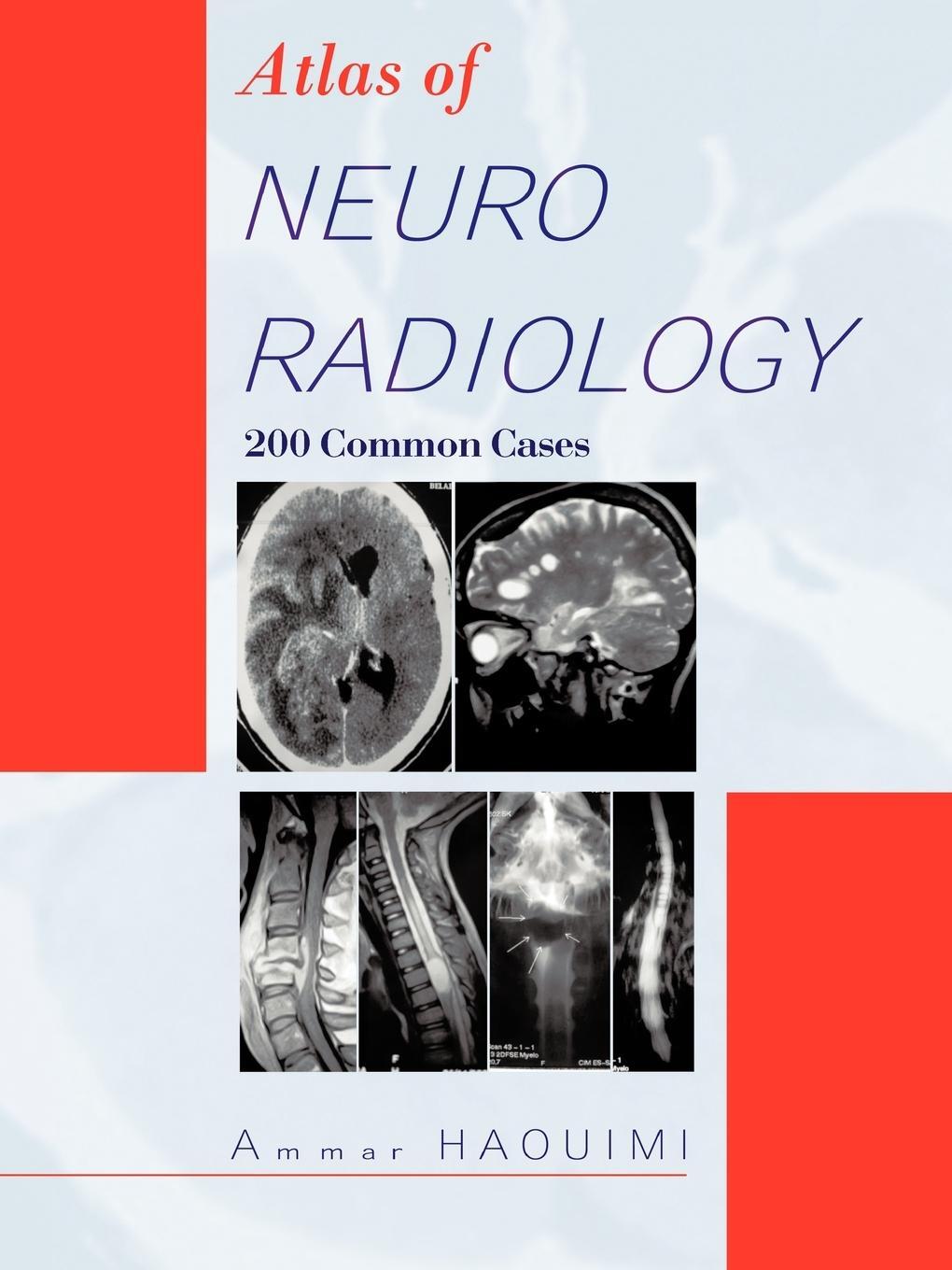 Cover: 9781426969683 | Atlas of Neuroradiology | 200 Common Cases | Ammar Haouimi | Buch