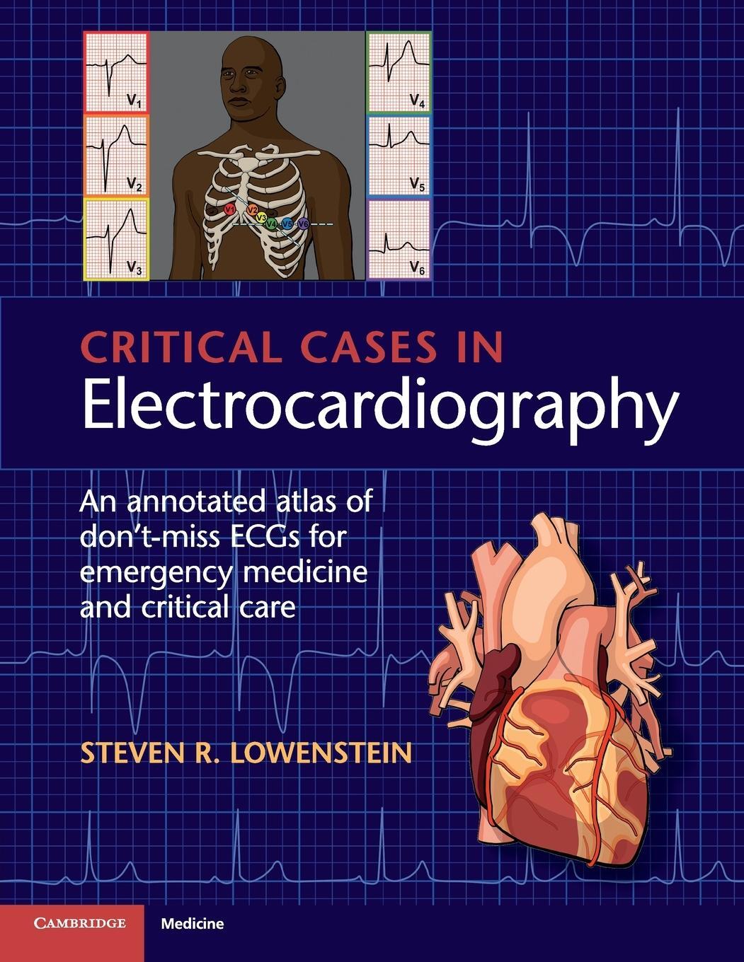 Cover: 9781107535916 | Critical Cases in Electrocardiography | Steven R. Lowenstein | Buch