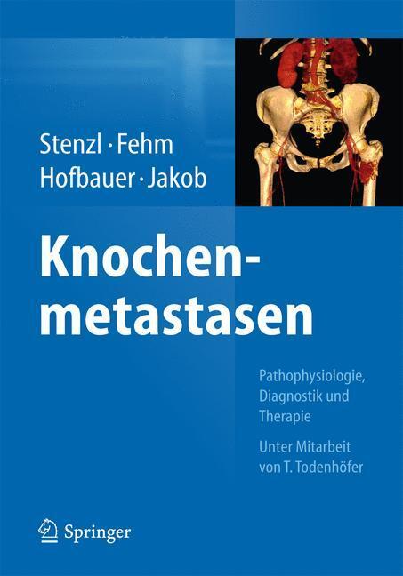 Cover: 9783662434703 | Knochenmetastasen | Arnulf Stenzl (u. a.) | Buch | Deutsch | 2014