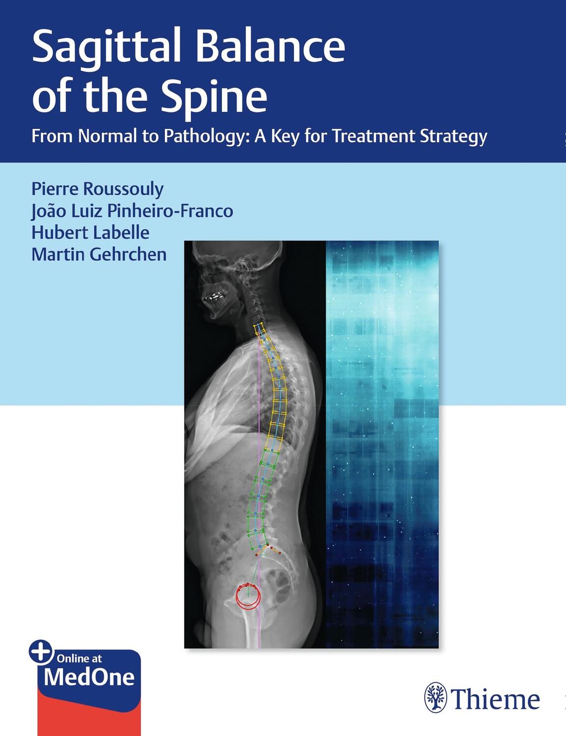 Cover: 9781626237322 | Sagittal Balance of the Spine: From Normal to Pathology: A Key for...