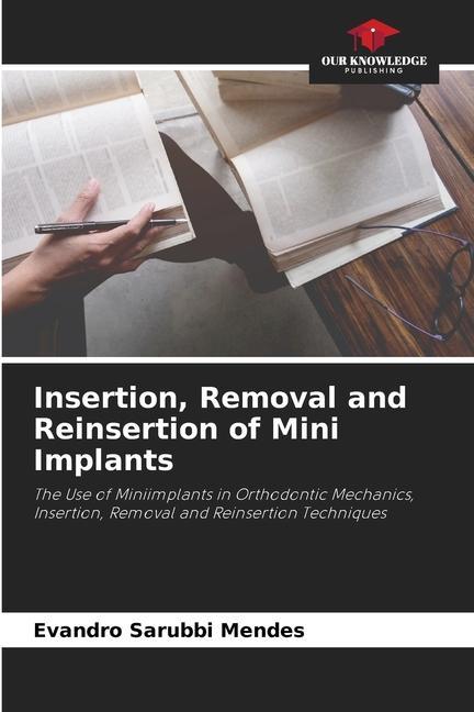 Cover: 9786206194156 | Insertion, Removal and Reinsertion of Mini Implants | Mendes | Buch