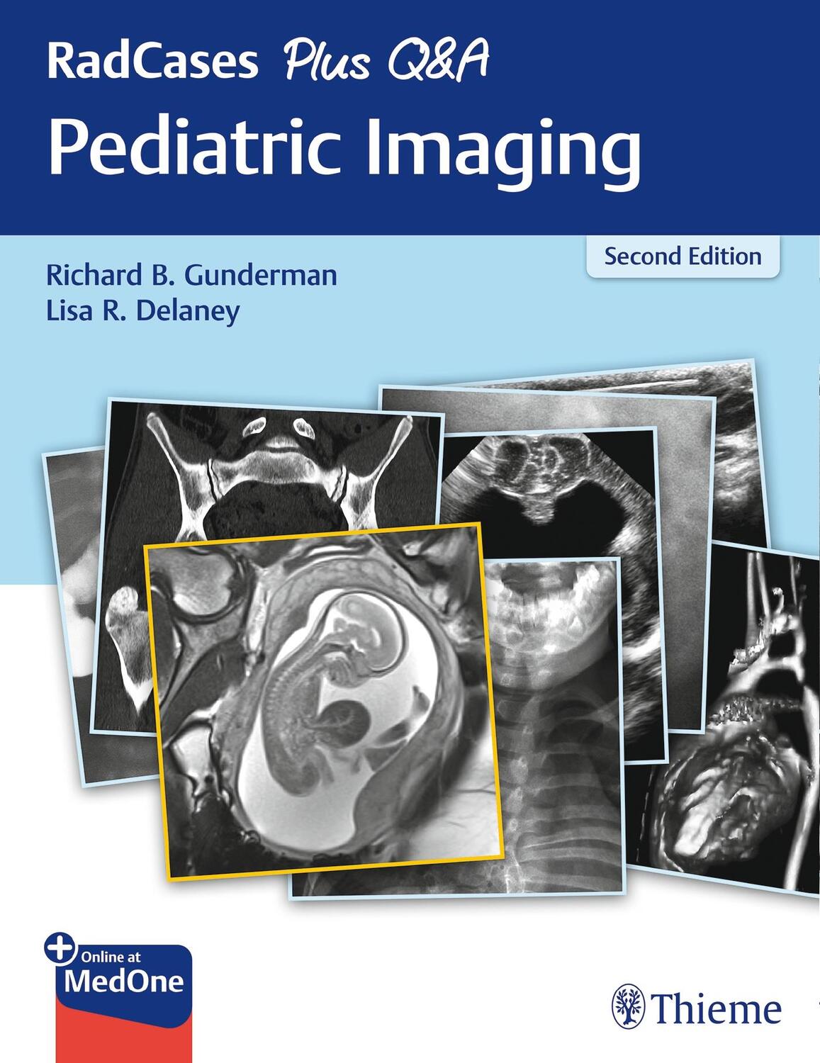 Cover: 9781626235199 | RadCases Plus Q&amp;A Pediatric Imaging | Richard B. Gunderman (u. a.)