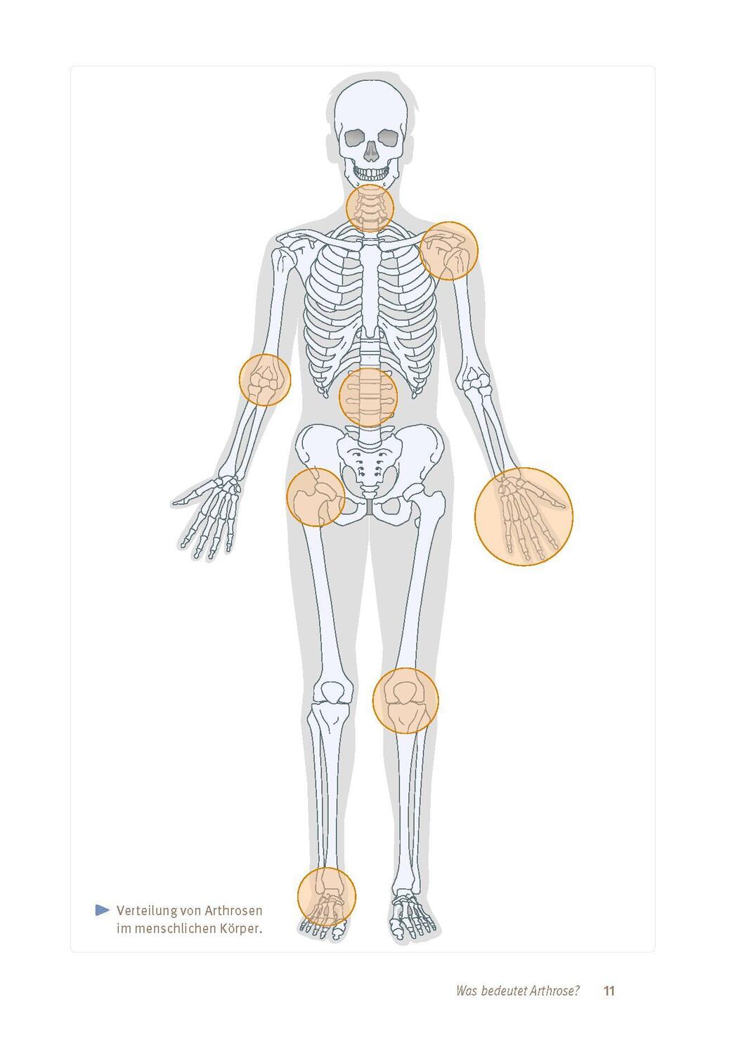 Bild: 9783432118918 | Expertenwissen: Arthrose | Hanno Steckel | Taschenbuch | 160 S. | 2024