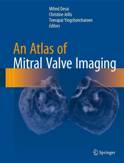 Bild: 9781447166719 | An Atlas of Mitral Valve Imaging | Milind Desai (u. a.) | Buch | xxvii