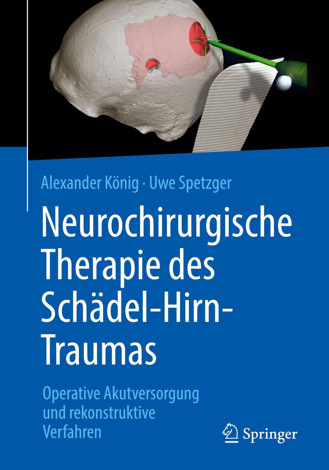 Cover: 9783662579275 | Neurochirurgische Therapie des Schädel-Hirn-Traumas | König | Buch