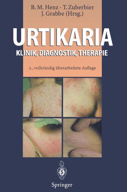 Cover: 9783642852428 | Urtikaria | Klinik, Diagnostik, Therapie | Beate M. Henz (u. a.) | XVI