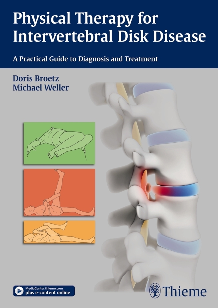 Cover: 9783131997616 | Physical Therapy for Intervertebral Disk Disease | Doris Brötz (u. a.)