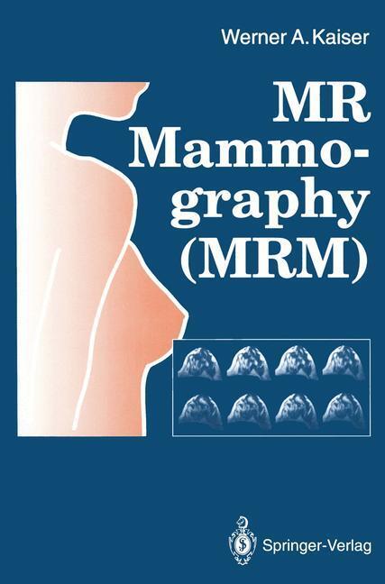 Cover: 9783642772580 | MR Mammography (MRM) | Werner A. Kaiser | Taschenbuch | Paperback