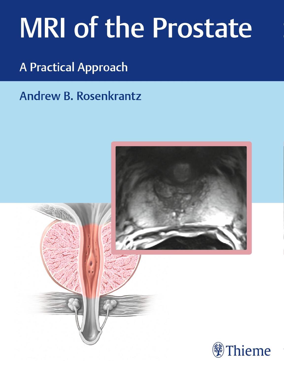 Cover: 9781626232686 | MRI of the Prostate | A Practical Approach | Andrew Rosenkrantz | Buch