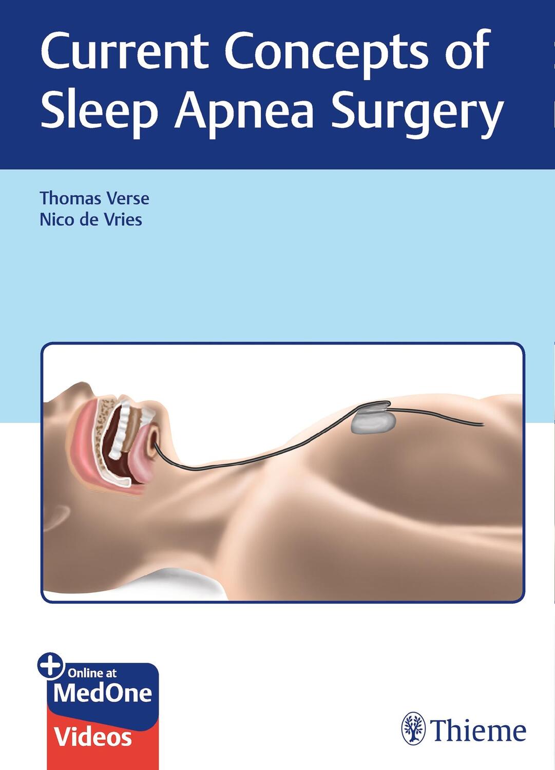 Cover: 9783132401198 | Current Concepts of Sleep Apnea Surgery | Thomas Verse (u. a.) | 2019