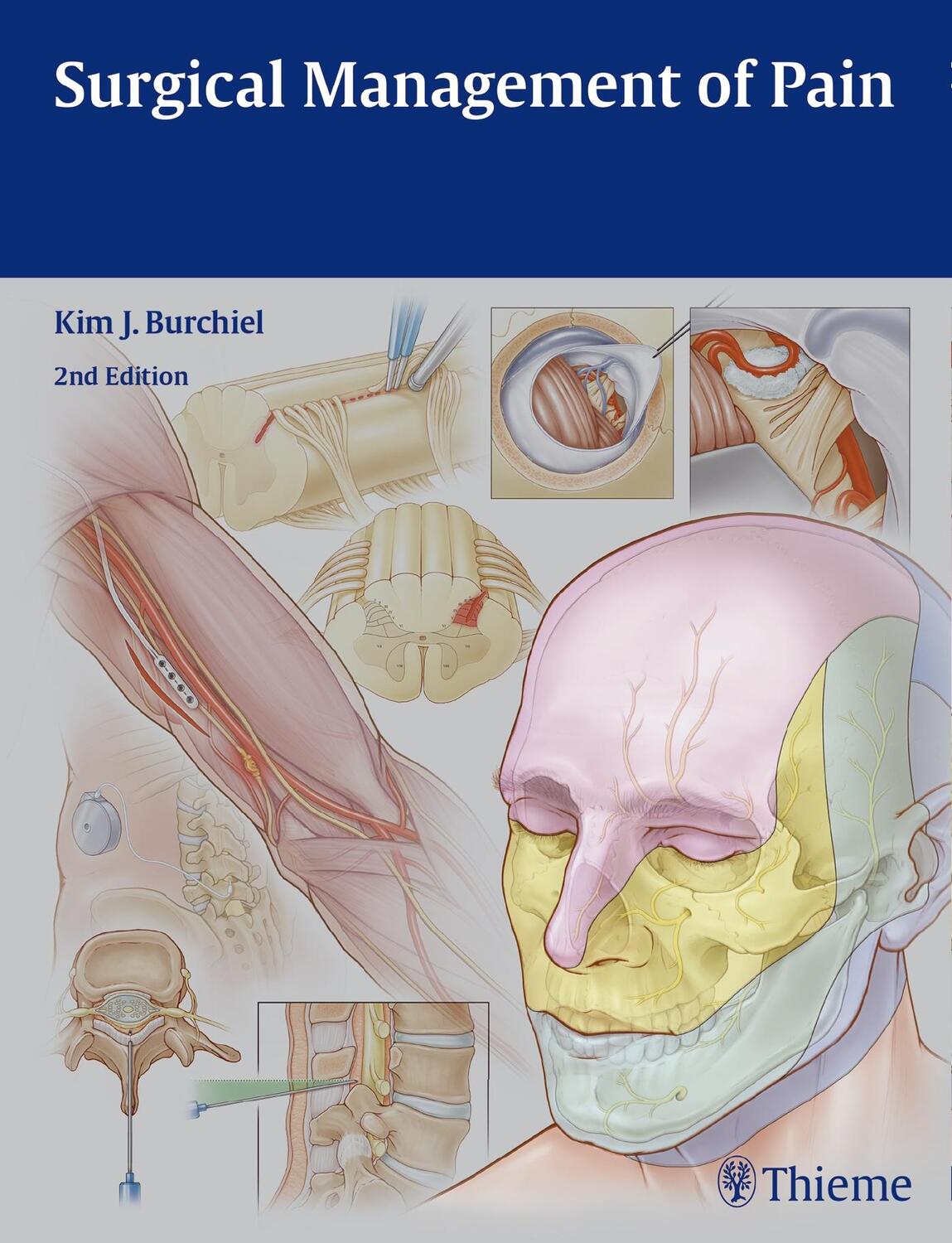 Cover: 9781604067514 | Surgical Management of Pain | Kim J Burchiel | Buch | 652 S. | 2015