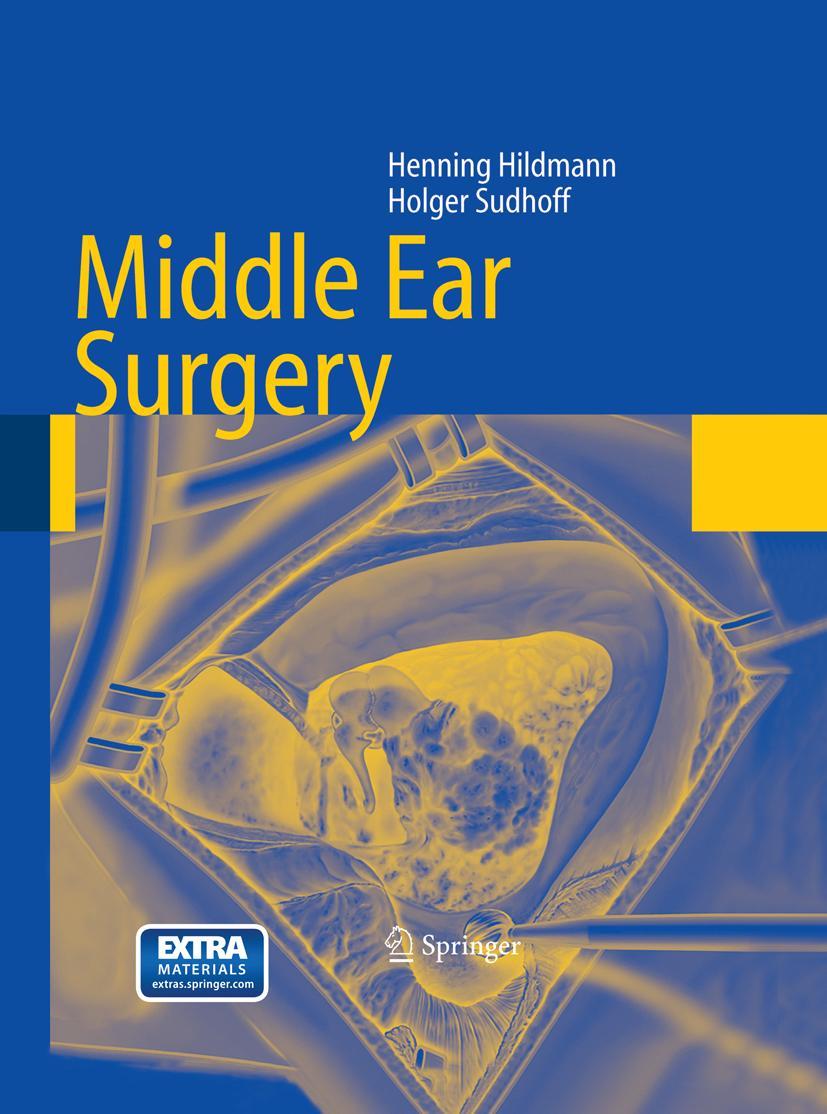 Cover: 9783662499894 | Middle Ear Surgery | Holger Sudhoff (u. a.) | Taschenbuch | xv | 2017