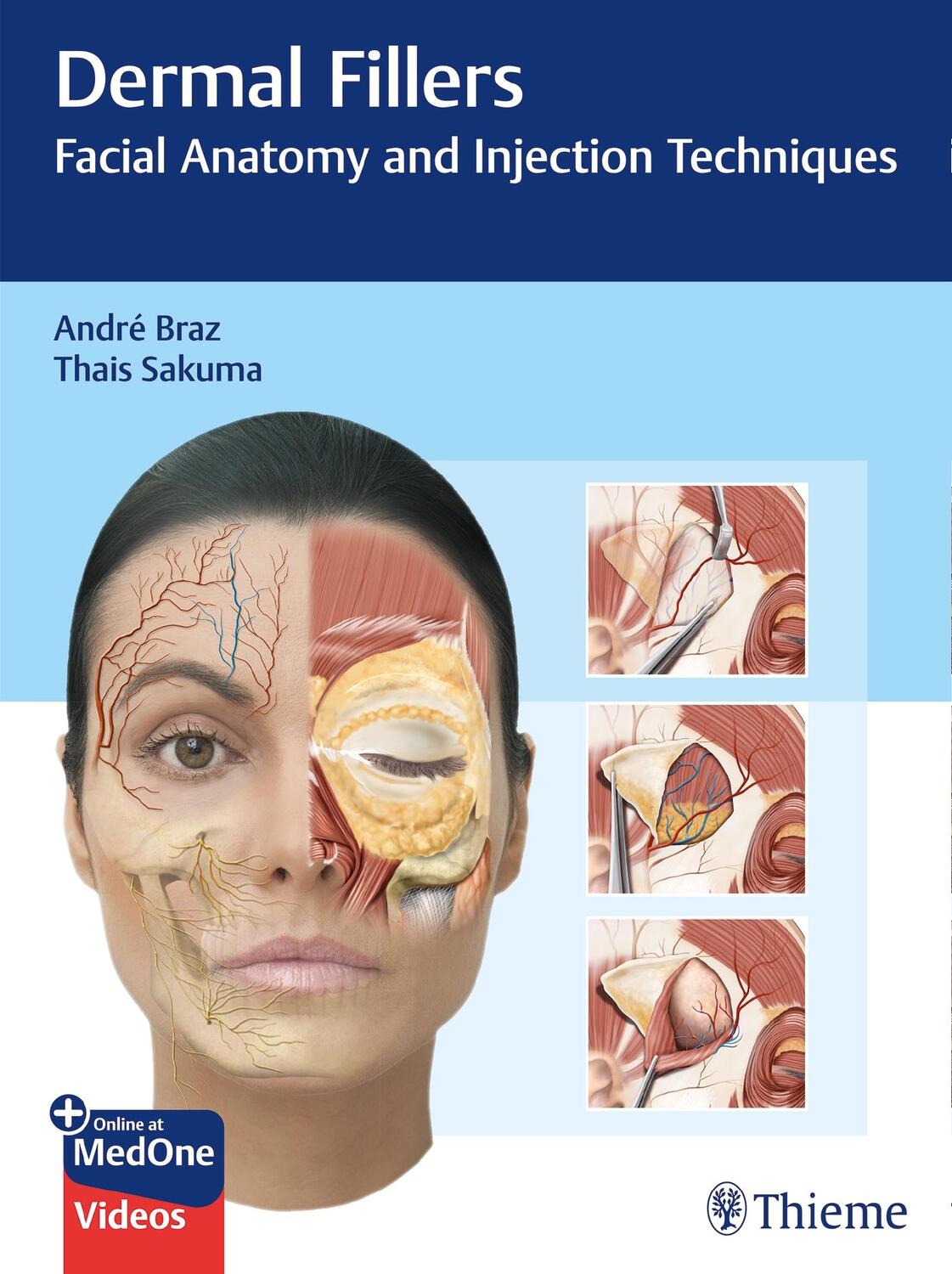 Cover: 9783132427723 | Dermal Fillers | Facial Anatomy and Injection Techniques | Bundle