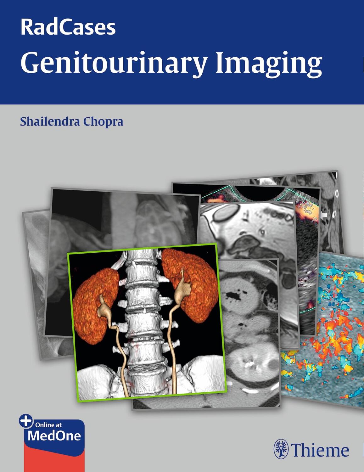 Cover: 9781604063240 | Radcases Genitourinary Imaging | Shailendra Chopra | Taschenbuch
