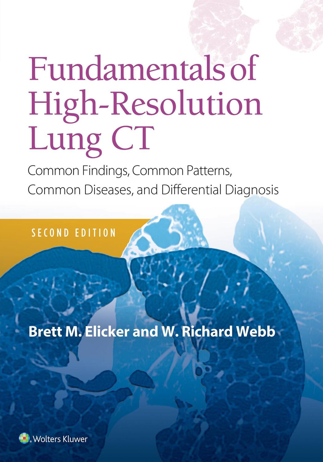 Cover: 9781496389923 | Fundamentals of High-Resolution Lung CT | Brett M. Elicker (u. a.)