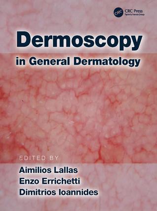 Cover: 9781138706569 | Dermoscopy in General Dermatology | Buch | Englisch | 2018
