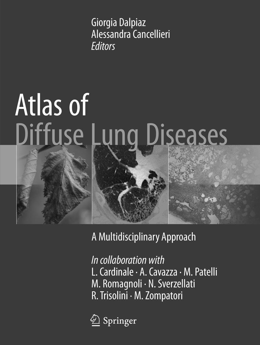 Cover: 9783319826547 | Atlas of Diffuse Lung Diseases | A Multidisciplinary Approach | Buch