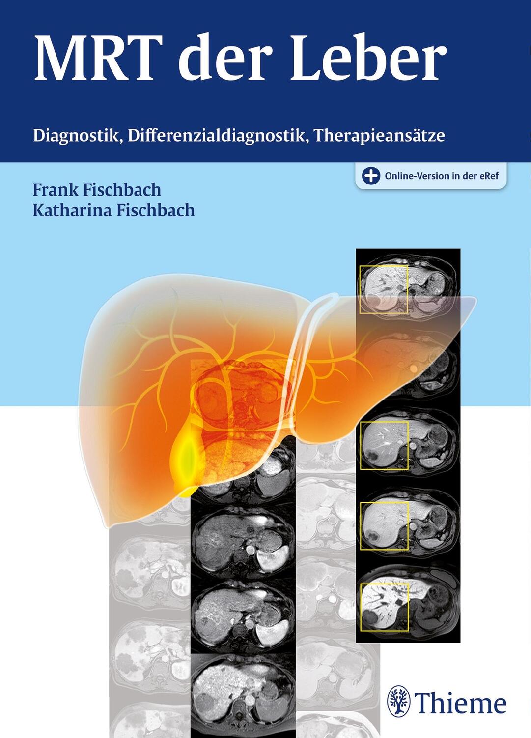 Cover: 9783131994417 | MRT der Leber | Diagnostik, Differenzialdiagnostik, Therapieansätze