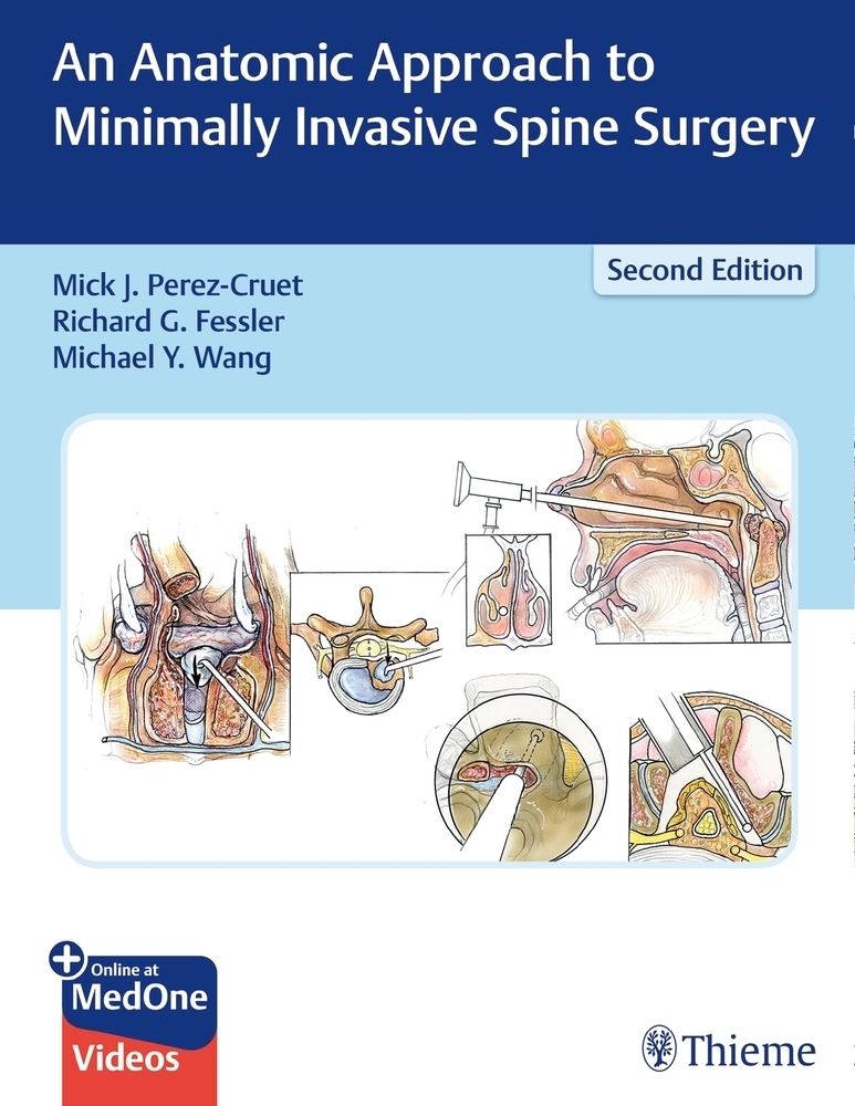 Cover: 9781626236431 | An Anatomic Approach to Minimally Invasive Spine Surgery | Bundle
