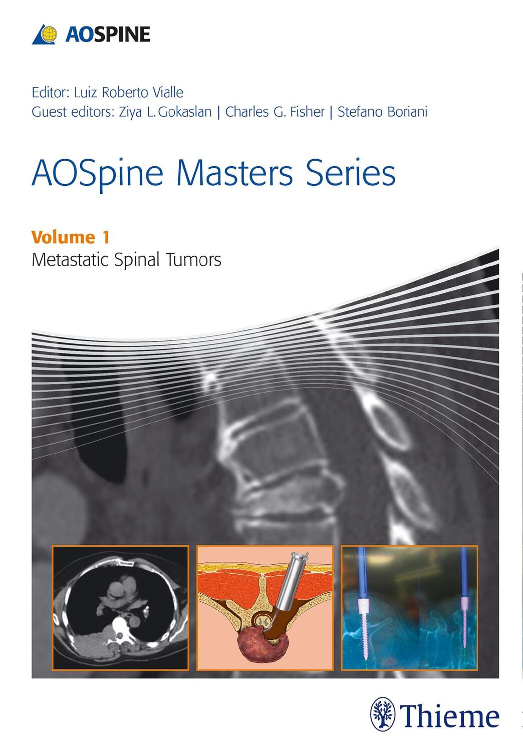 Cover: 9781626230460 | Aospine Masters Series Volume 1: Metastatic Spinal Tumors | Vialle