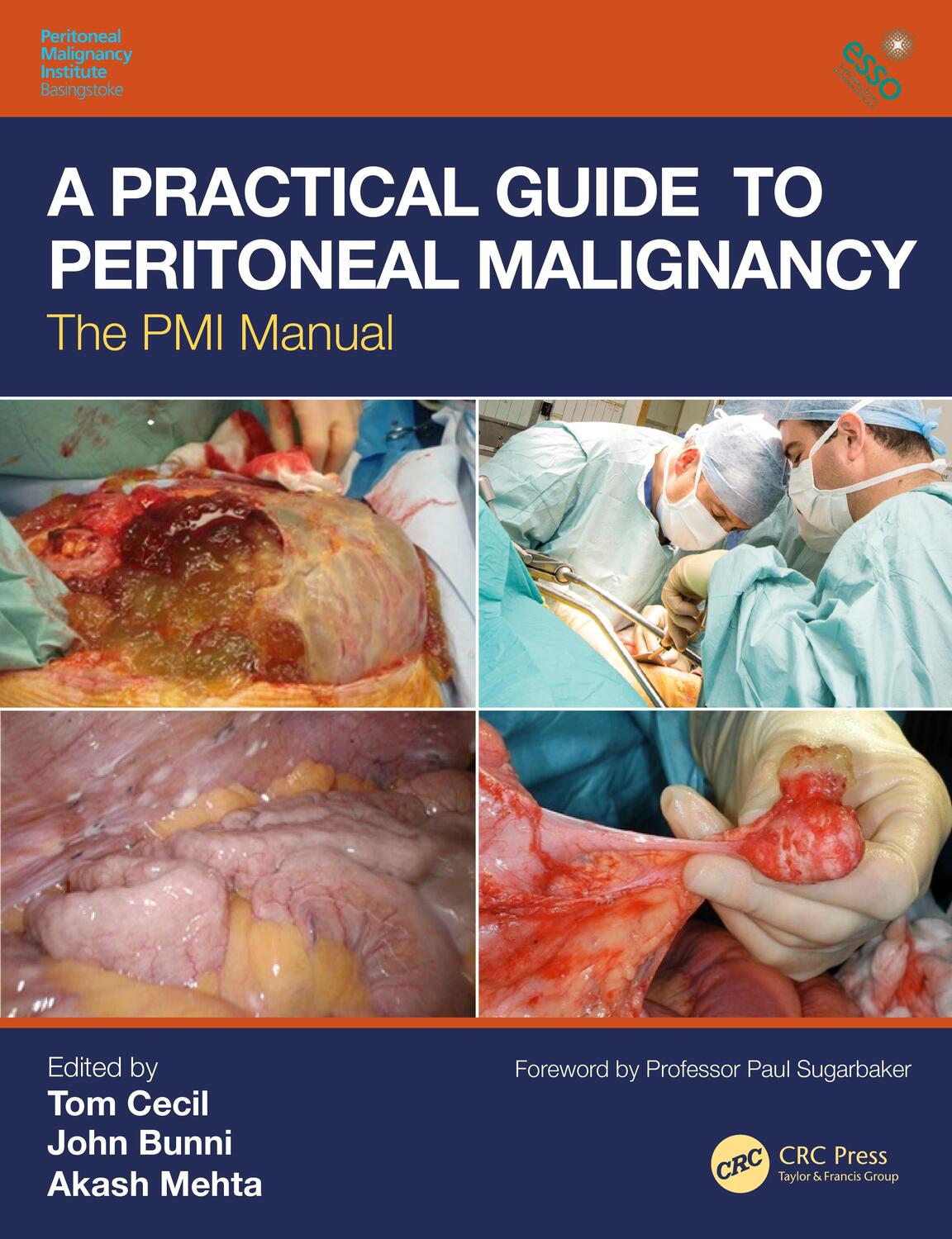 Cover: 9781138495111 | A Practical Guide to Peritoneal Malignancy | The PMI Manual | Buch