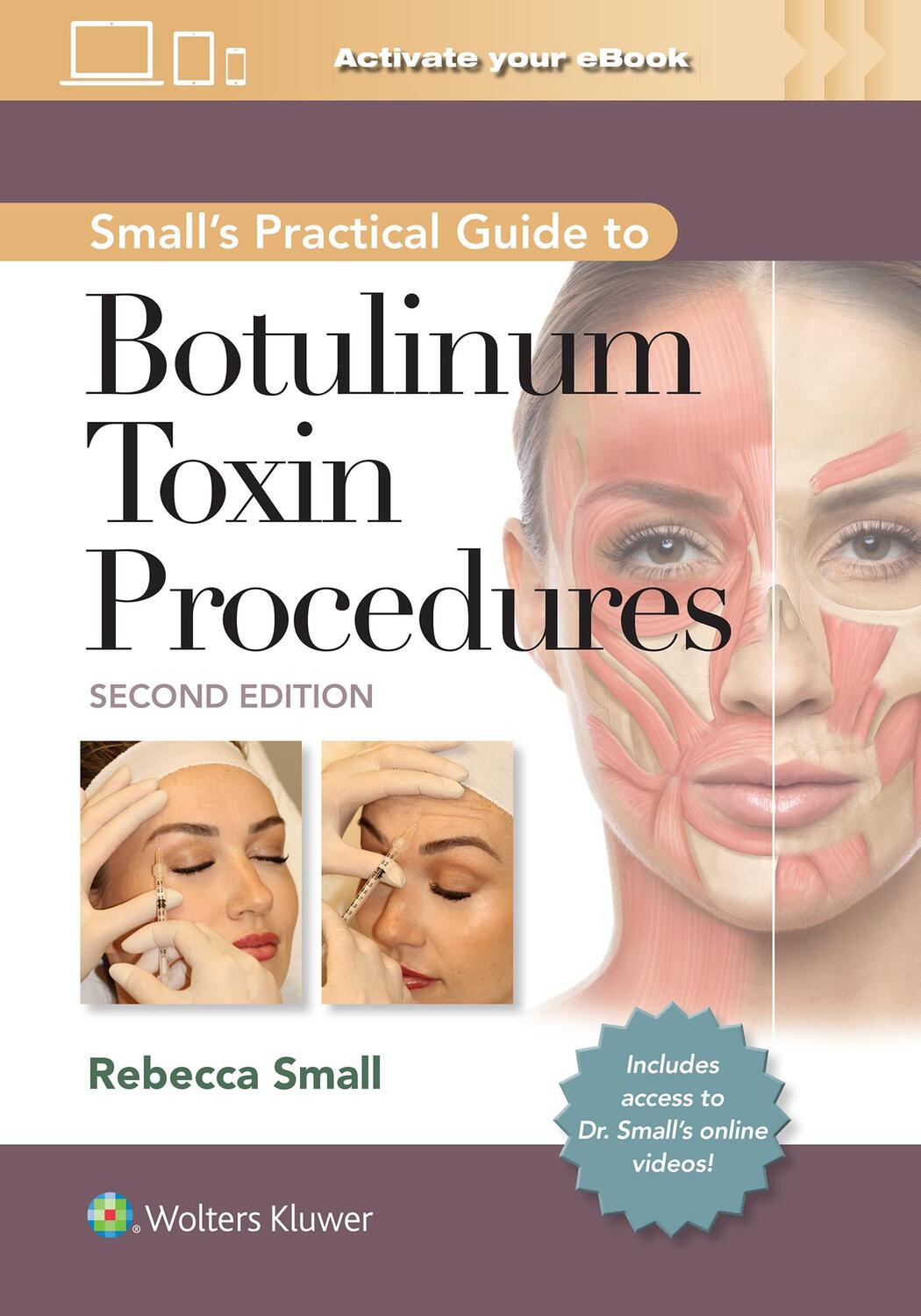 Cover: 9781975192853 | A Practical Guide to Botulinum Toxin Procedures | Small (u. a.) | Buch