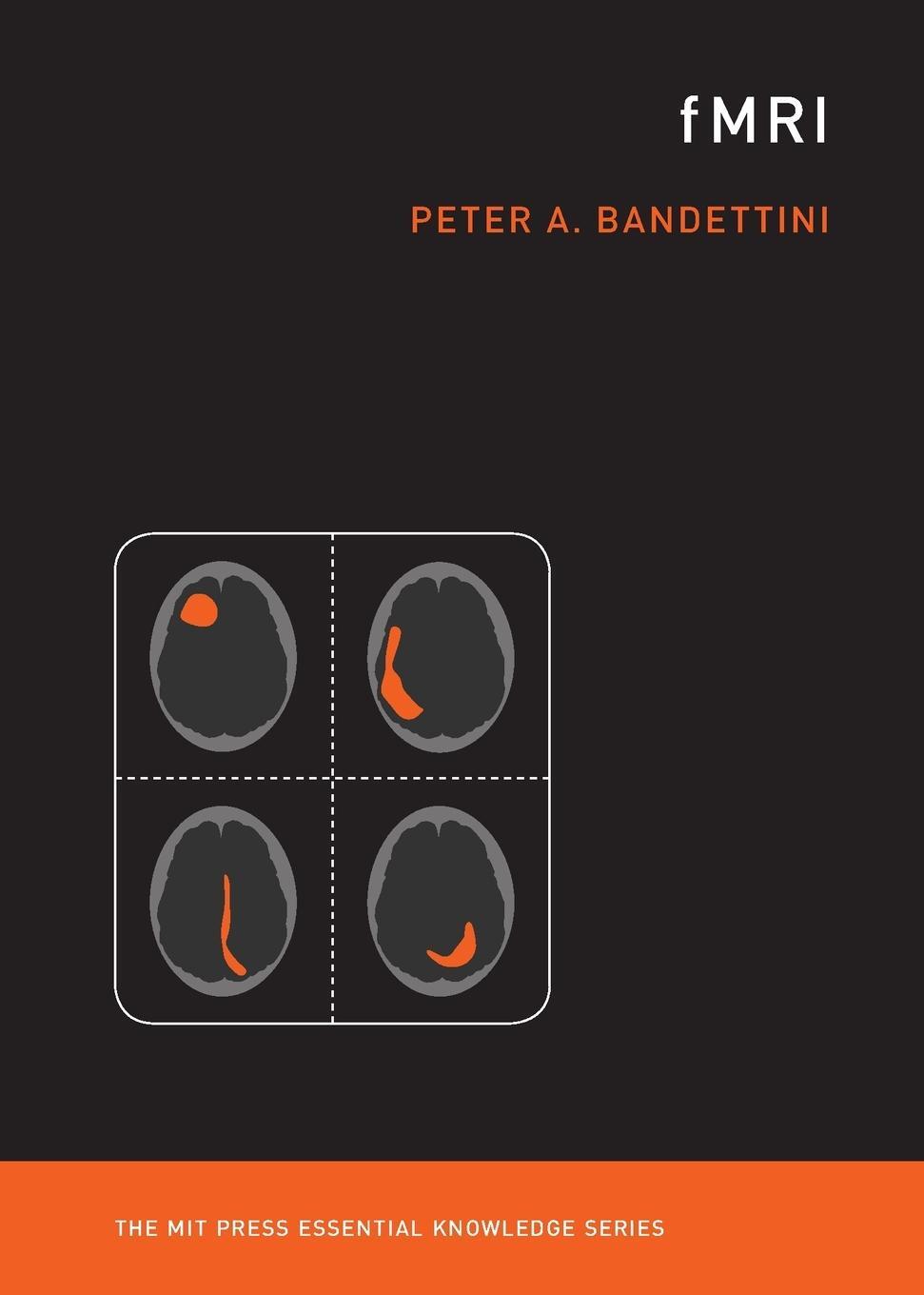 Cover: 9780262538039 | fMRI | Peter A. Bandettini | Taschenbuch | Paperback | Englisch | 2020