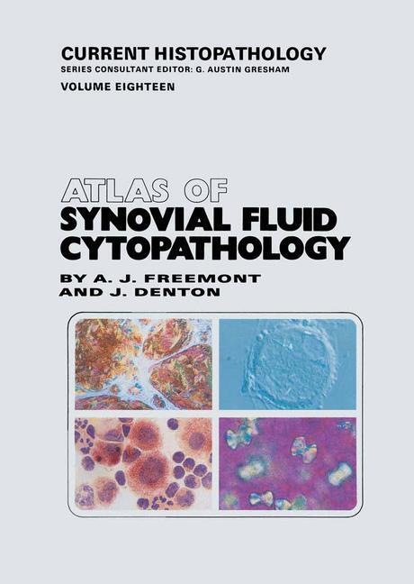 Cover: 9789401057028 | Atlas of Synovial Fluid Cytopathology | Jayne Denton (u. a.) | Buch