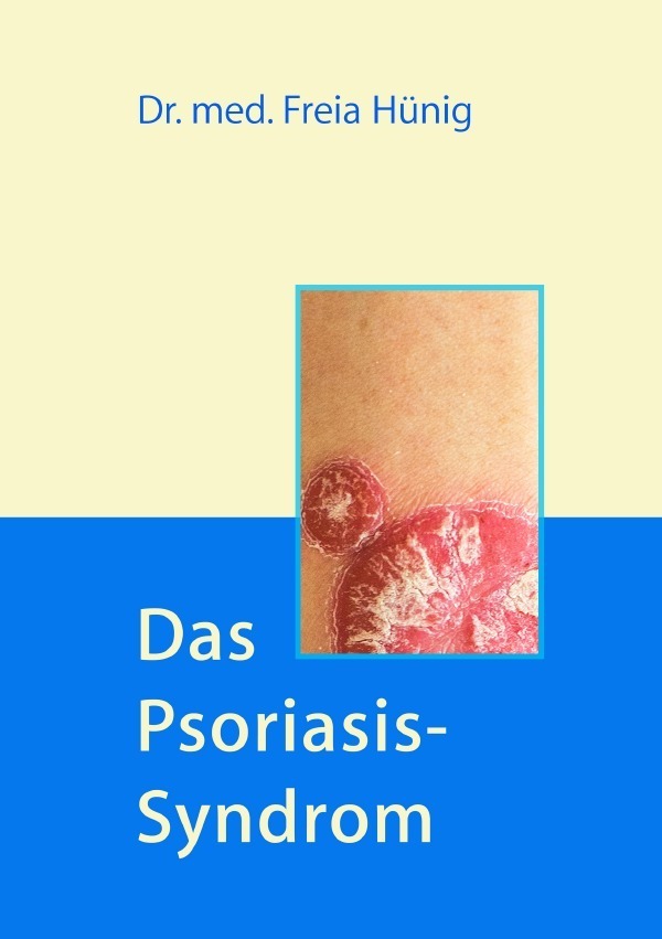 Cover: 9783745088403 | Das Psoriasis-Syndrom | Freia Hünig | Taschenbuch | epubli
