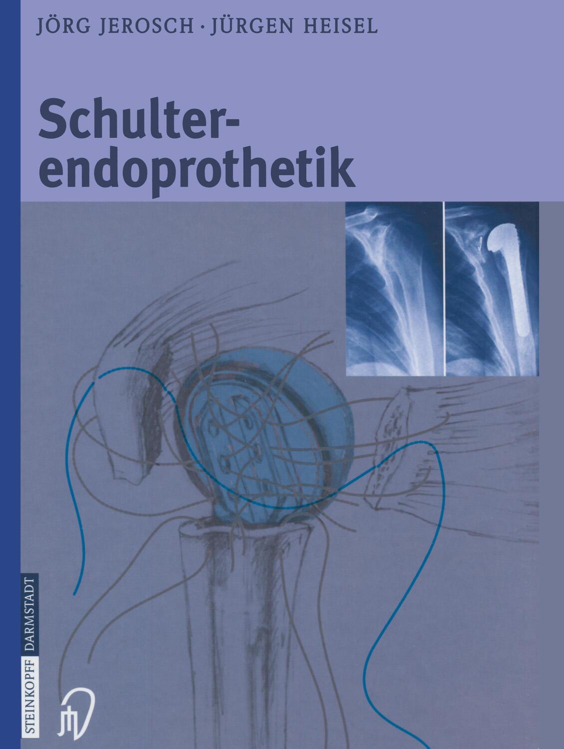 Cover: 9783798513303 | Schulterendoprothetik | Jürgen Heisel (u. a.) | Buch | XII | Deutsch