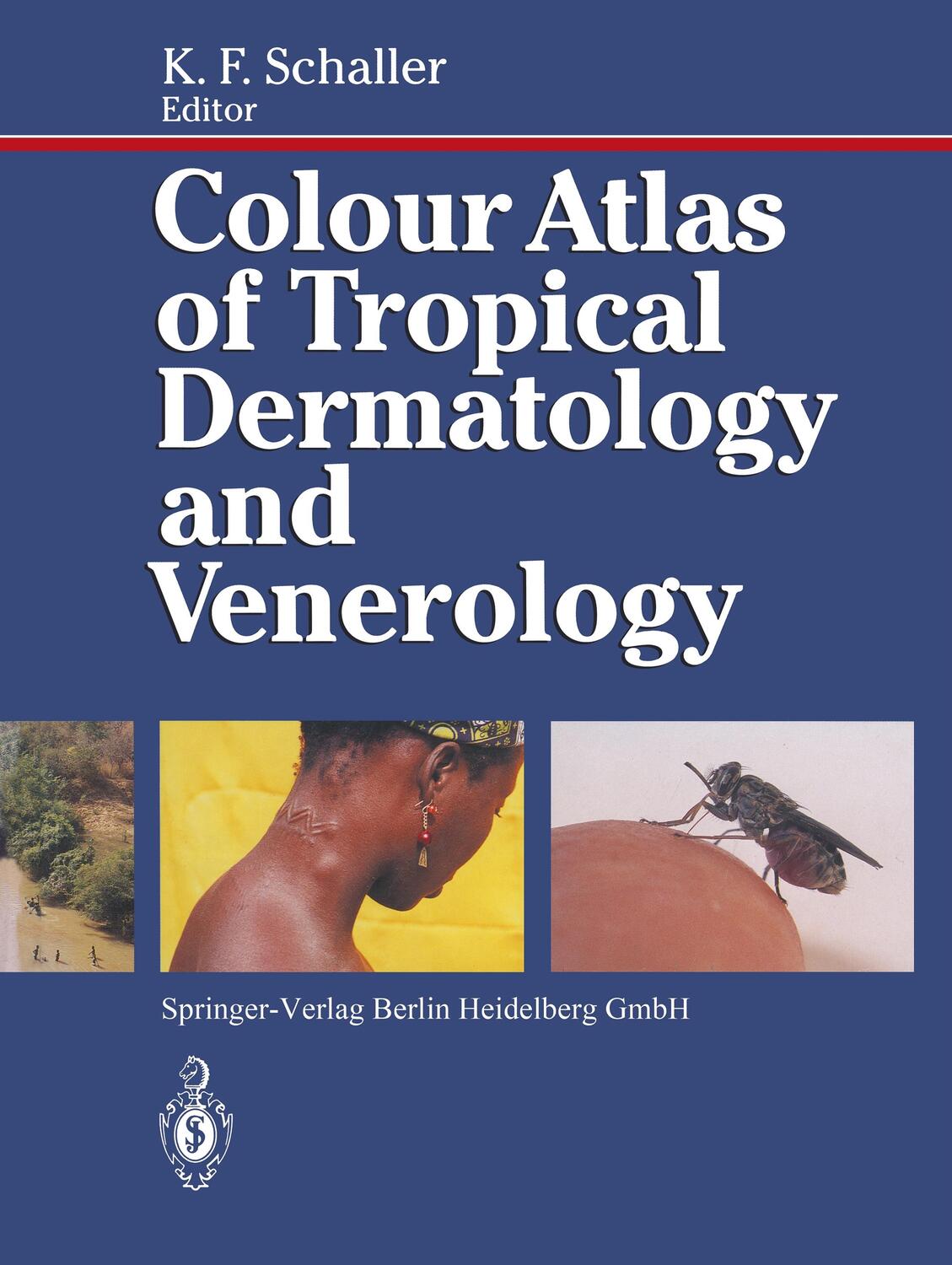 Cover: 9783642762024 | Colour Atlas of Tropical Dermatology and Venerology | Karl F. Schaller