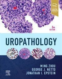 Cover: 9780323653954 | Uropathology | Ming, MD, PhD Zhou (u. a.) | Buch | Gebunden | Englisch