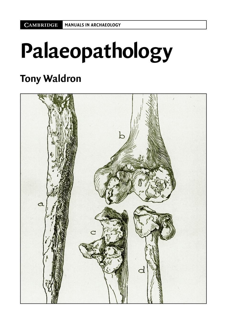 Cover: 9780521678551 | Palaeopathology | Tony Waldron | Taschenbuch | Paperback | Englisch