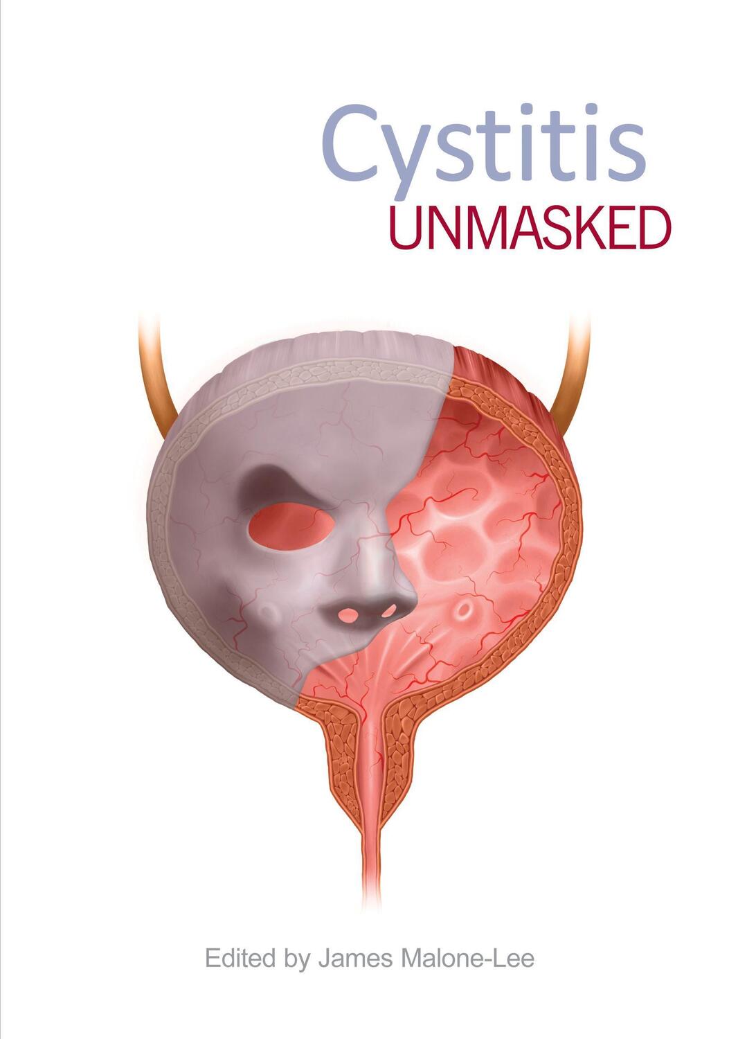 Cover: 9781910079638 | Cystitis Unmasked | James Malone-Lee | Taschenbuch | Englisch | 2021