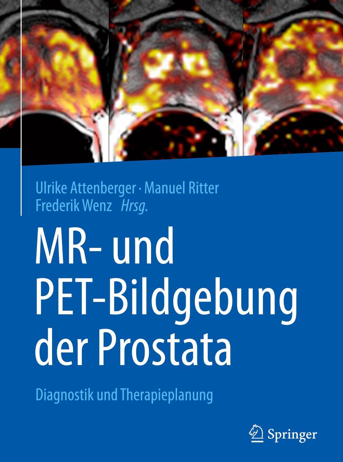 Cover: 9783662504673 | MR- und PET-Bildgebung der Prostata | Diagnostik und Therapieplanung