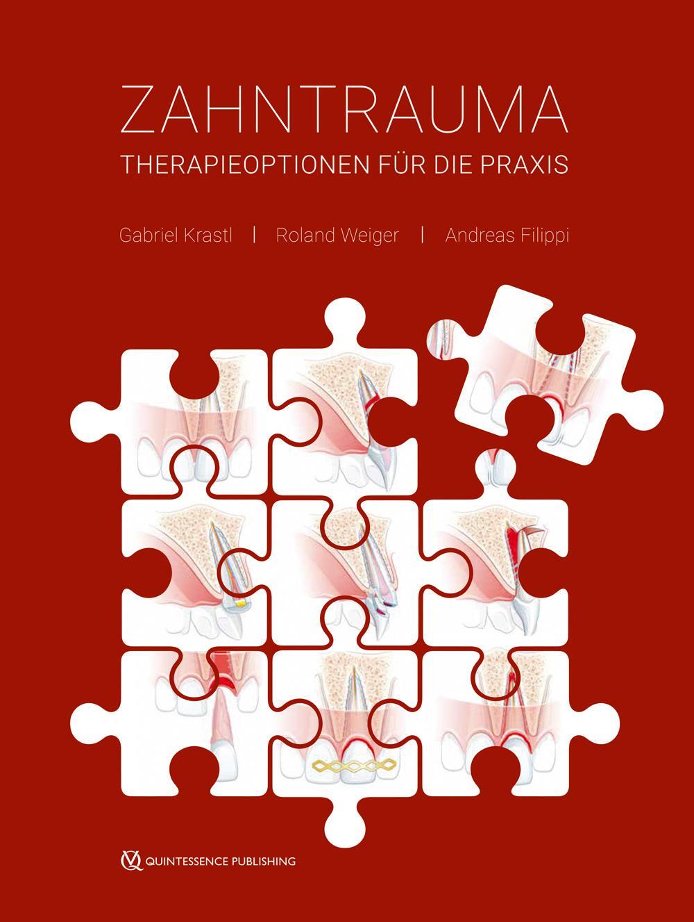 Cover: 9783868675016 | Zahntrauma | Therapieoptionen für die Praxis | Gabriel Krastl (u. a.)