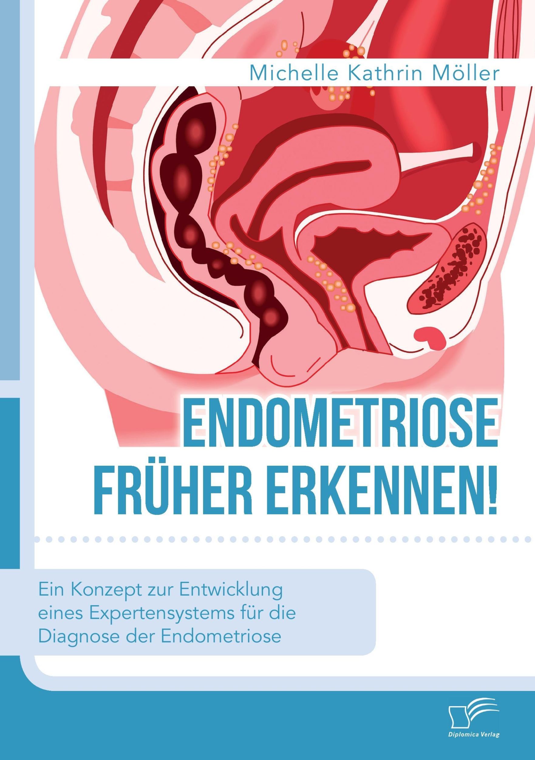 Cover: 9783961465651 | Endometriose früher erkennen! Ein Konzept zur Entwicklung eines...