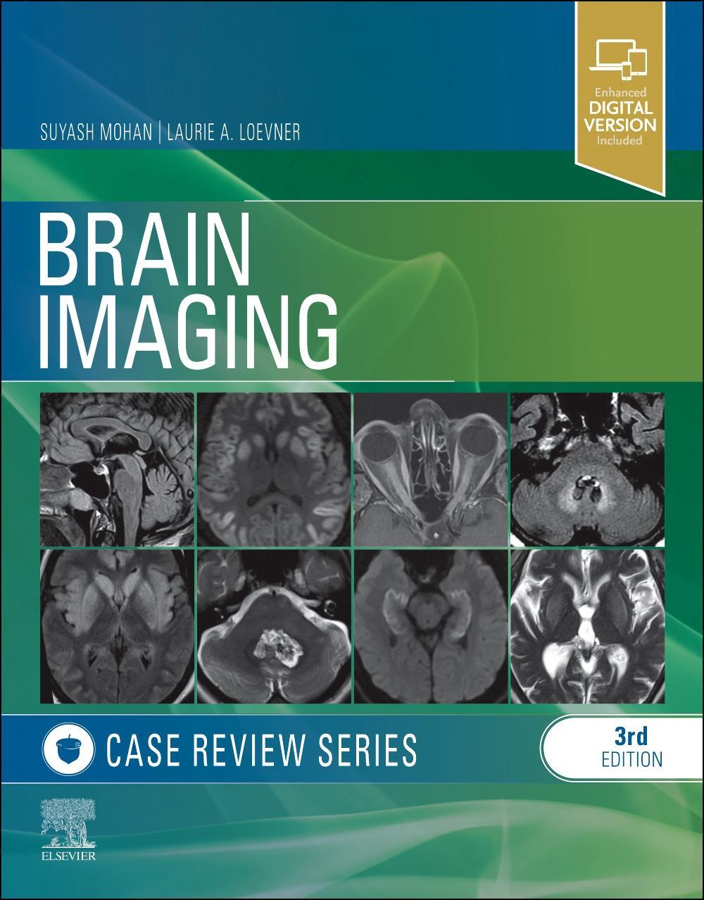 Cover: 9781455774852 | Brain Imaging: Case Review Series | Laurie A. Loevner (u. a.) | Buch
