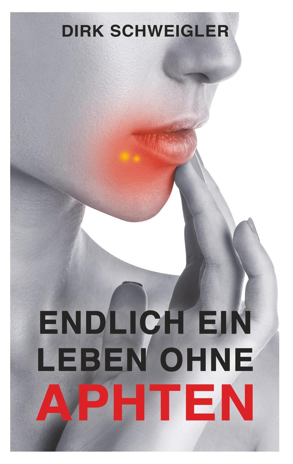 Cover: 9783748178248 | Endlich ein Leben ohne Aphten | Dirk Schweigler | Taschenbuch
